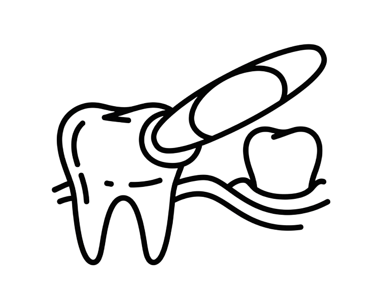 Instalação Clínica das Lentes