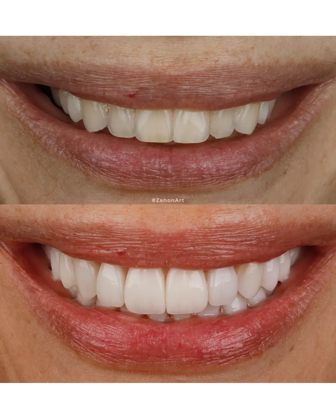 Imagen de Resultados