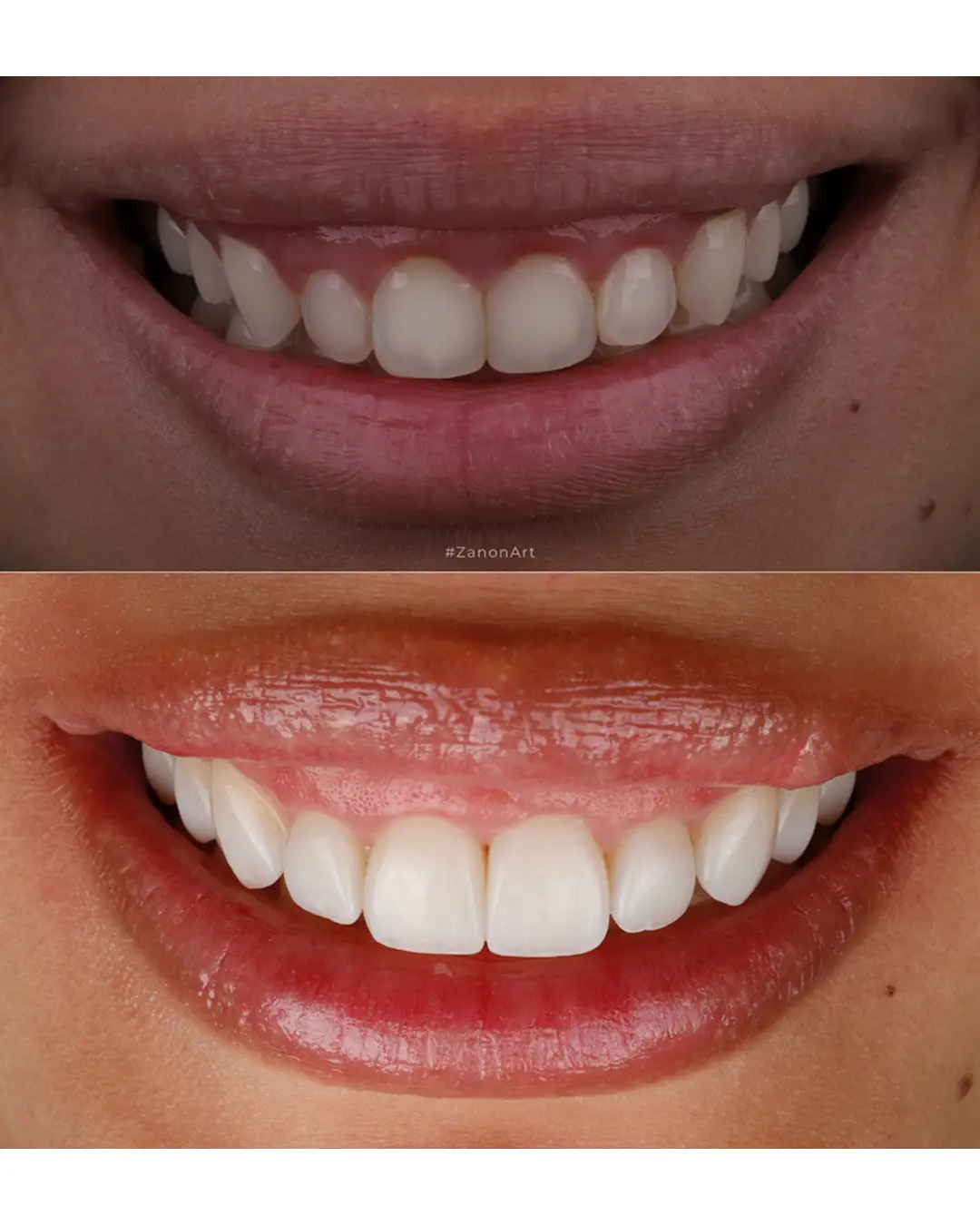 Imagen de Resultados