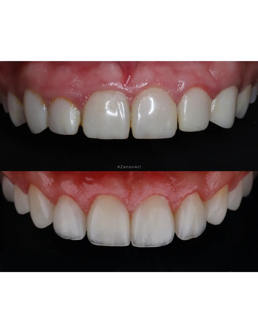 Imagen de Resultados