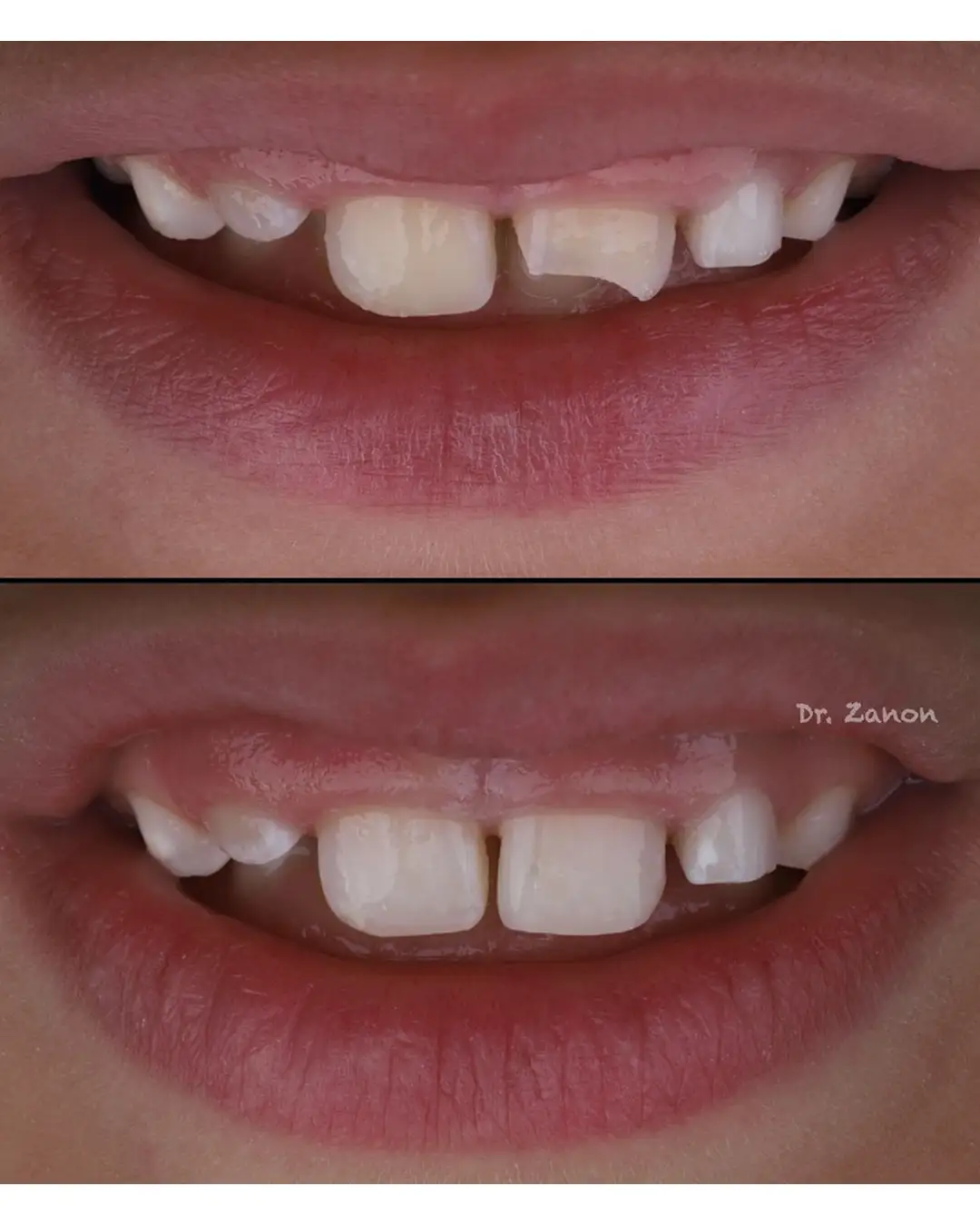 Imagen de Resultados