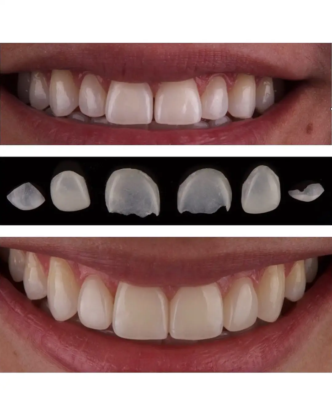 Imagen de Resultados