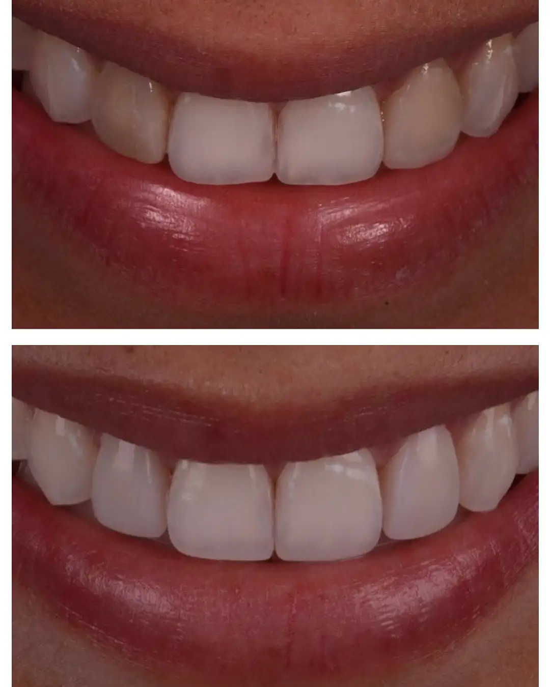 Imagen de Resultados