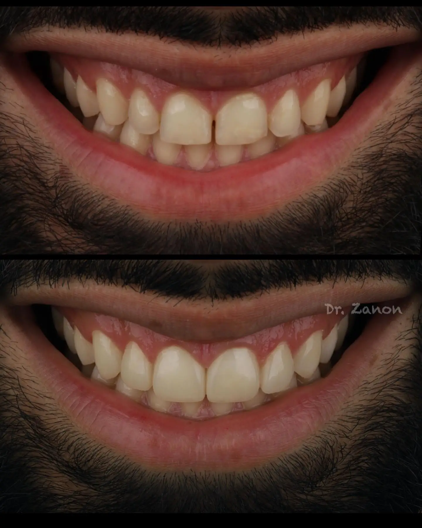 Imagen de Resultados