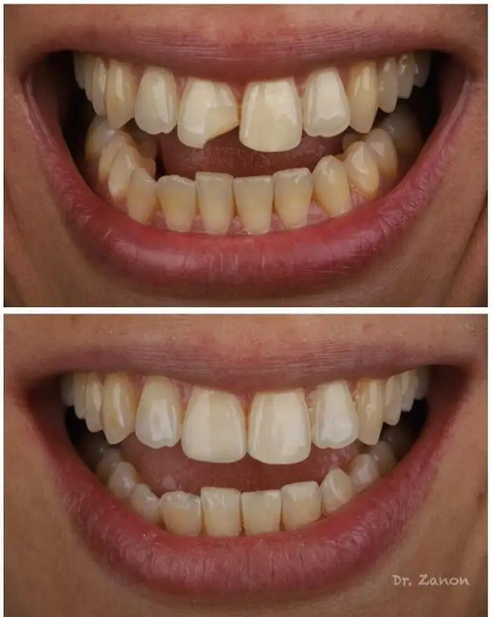 Imagen de Resultados