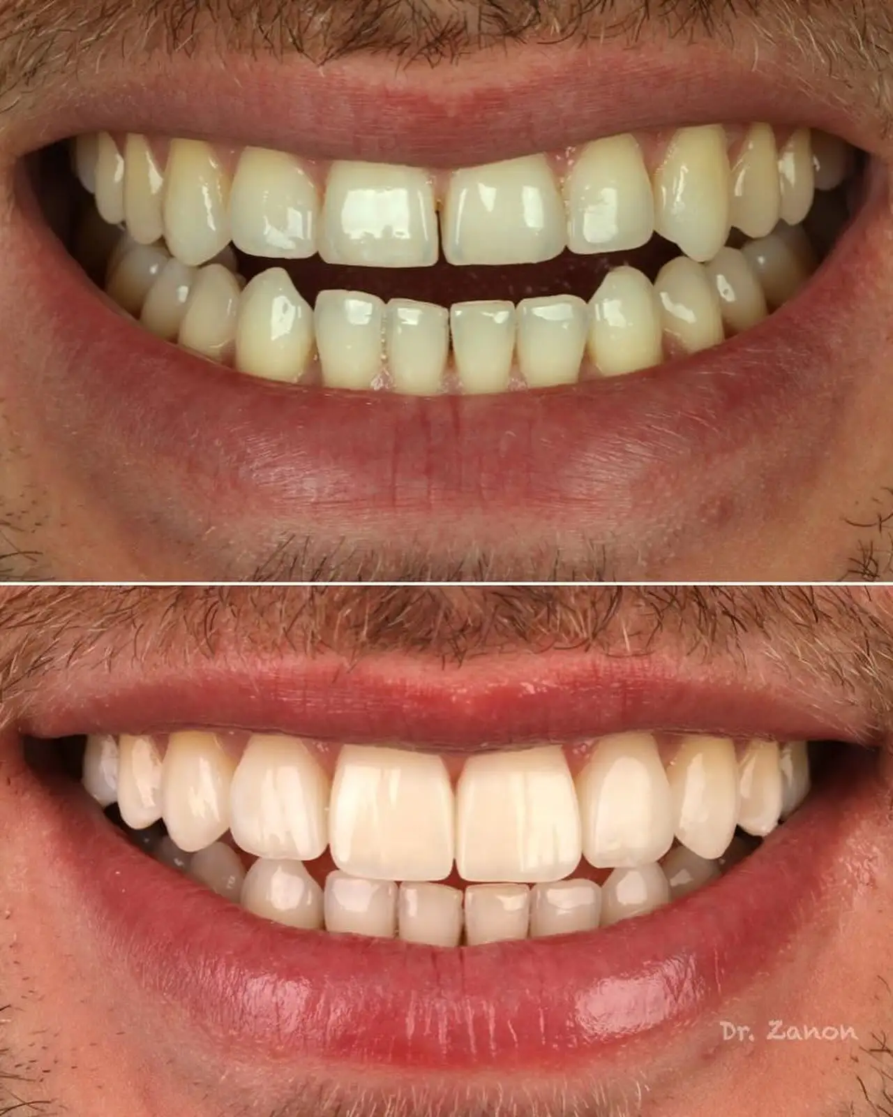 Imagen de Resultados