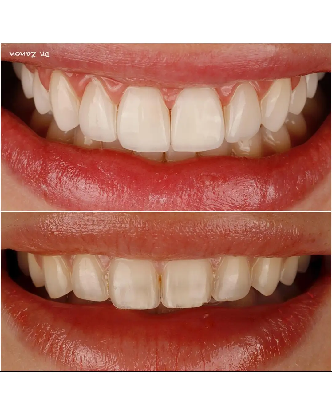 Imagen de Resultados